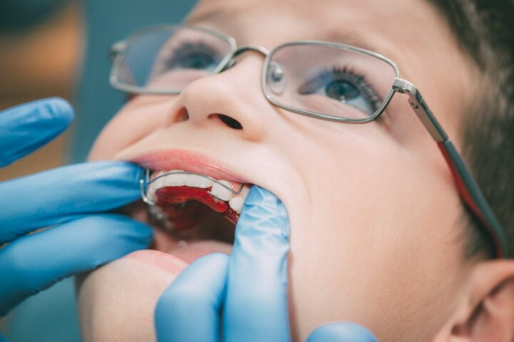 Little Boy At The Dentist